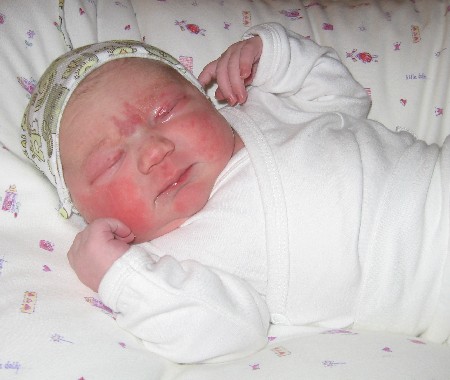 Babybild